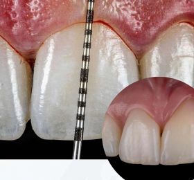 Periodontia